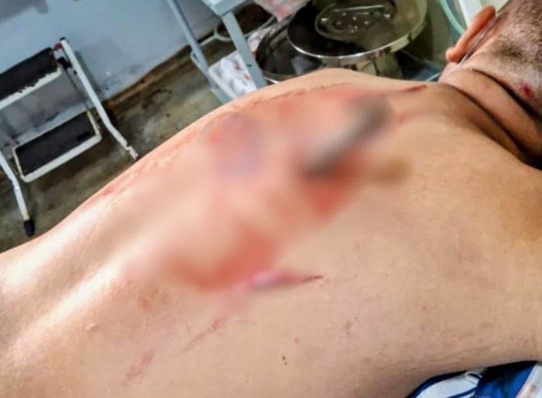 No AM, ex-marido esfaqueia rival pelas costas em briga por ciúmes