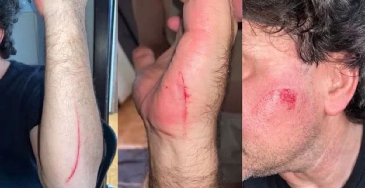 Motorista de aplicativo é atacado com facão por passageiro durante corrida