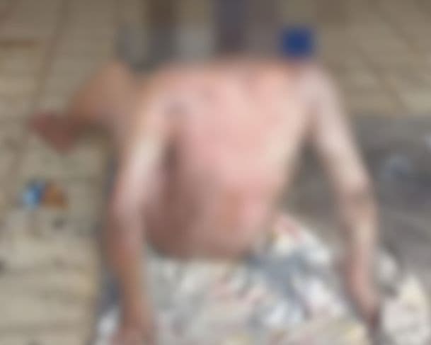 VÍDEO: “Passarinho” é preso após incendiar colega de quarto em Tefé; vítima está em estado grave