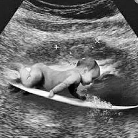 Com bebê na prancha, Gabriel Medina anuncia que vai ser pai