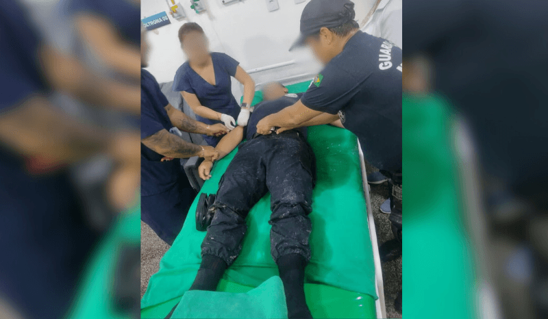 Guarda Municipal fica ferido ao ser atingido por estrutura de ferro que desabou durante temporal em Tefé