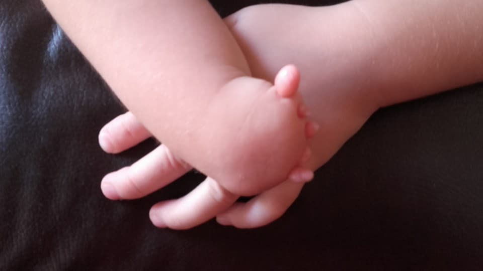 Vereador sugere instituir 30 de setembro como Dia da Conscientização da Agenesia de Membros