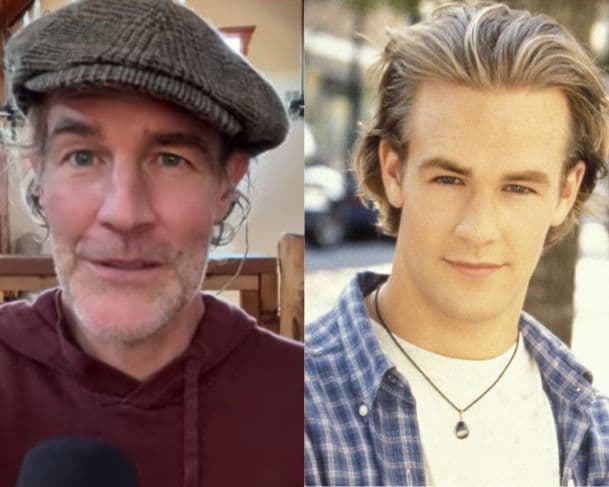 Astro de Dawson’s Creek anuncia leilão de itens valiosos para custear tratamento contra câncer