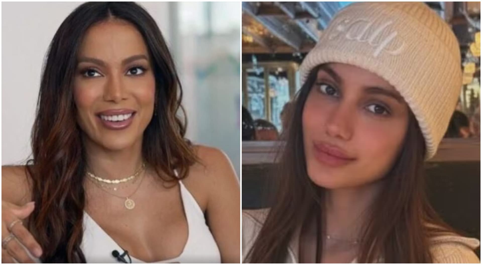 Anitta chama atenção ao aparecer com rosto diferente nas redes sociais