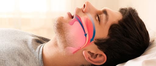 Respirar pela boca pode provocar problemas orais e até alterações na postura