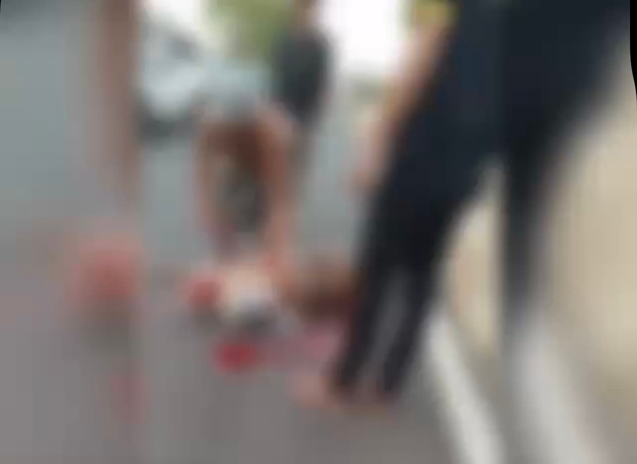 Idoso tem pé decepado em atropelamento na BR-316 e morre em Teresina