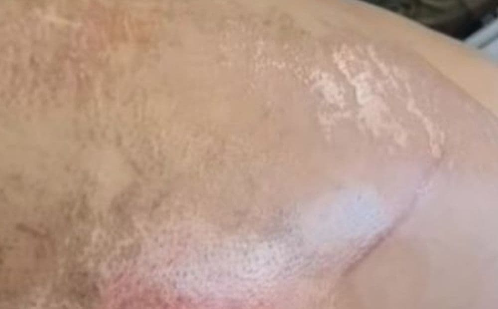 Homem atropela ex-mulher no momento que vítima descia de moto no Amazonas