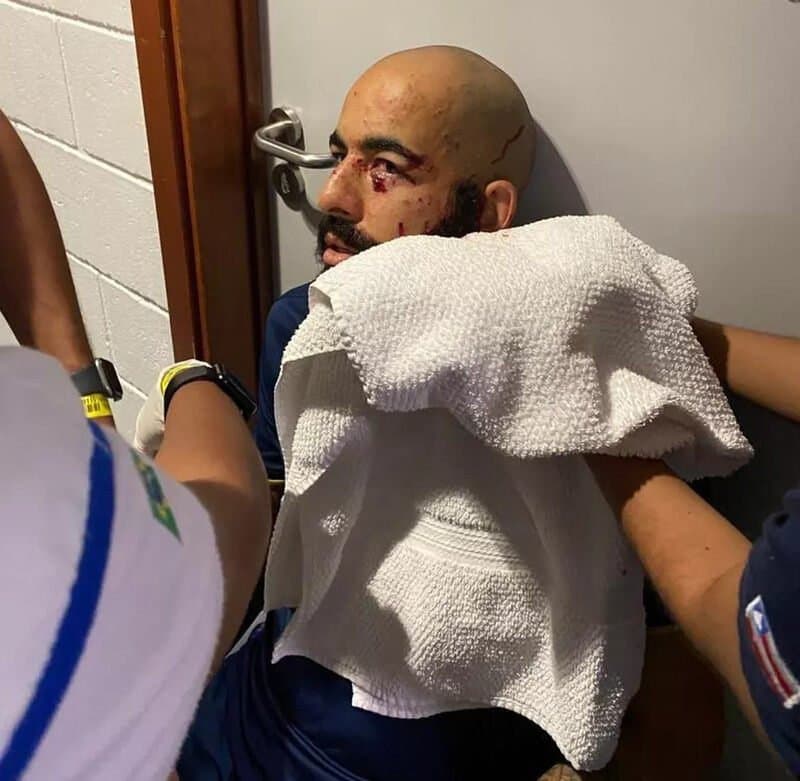 Bomba deixa jogadores do Bahia feridos durante chegada à Arena Fonte Nova