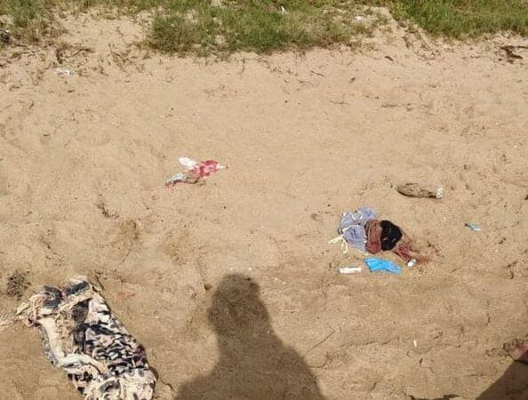 “Ação praticada por terceiros”, diz advogado sobre caso de jovem encontrado com corte no intestino