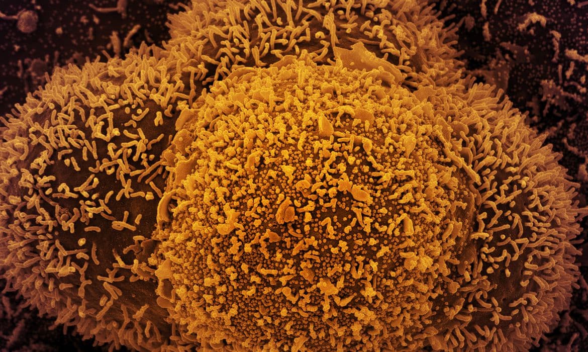 Brasil confirma casos da linhagem BA.2 da variante ômicron