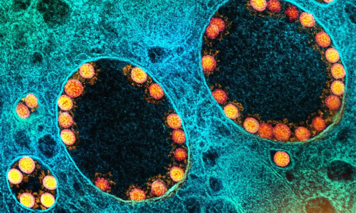 São Paulo registra primeira morte por ômicron BQ.1.1
