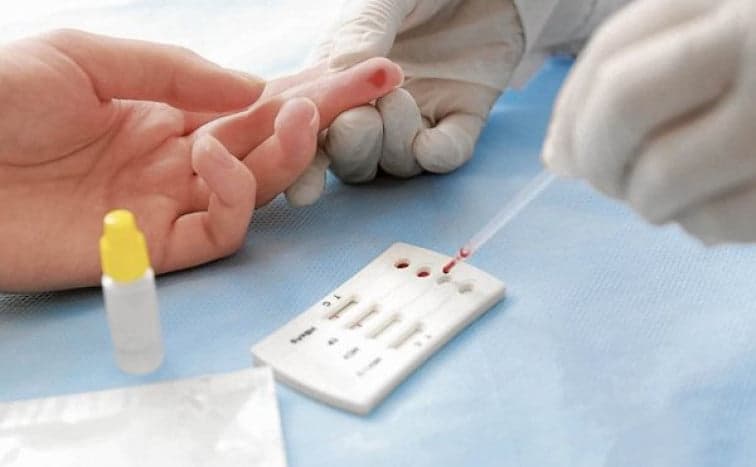 Manaus amplia postos de testagem rápida contra Covid