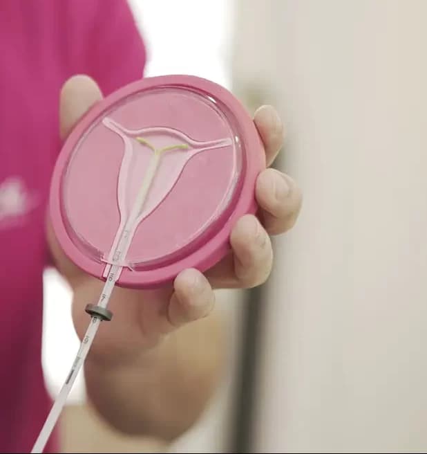 Lei que proíbe autorização do cônjuge para mulher usar DIU é sancionada no AM