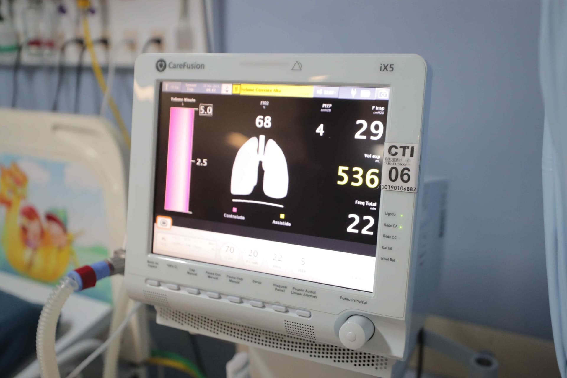 Rede de saúde do Amazonas ganha novos leitos pediátricos clínicos e de UTI