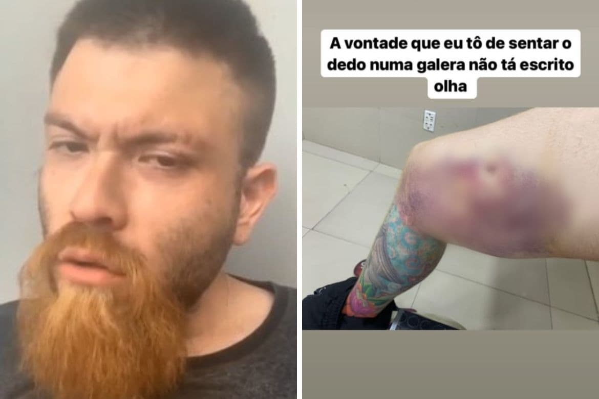 VÍDEO: ‘DJ maluco’ é solto, mostra perna baleada e pede dinheiro na internet em Manaus