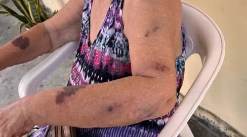 Idosa é resgatada após ser agredida pela neta com cabo de vassoura, em Manaus