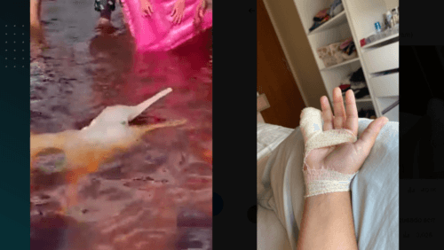 VÍDEO: Mulher tem o dedo mordido por boto cor-de-rosa durante passeio a praia no AM