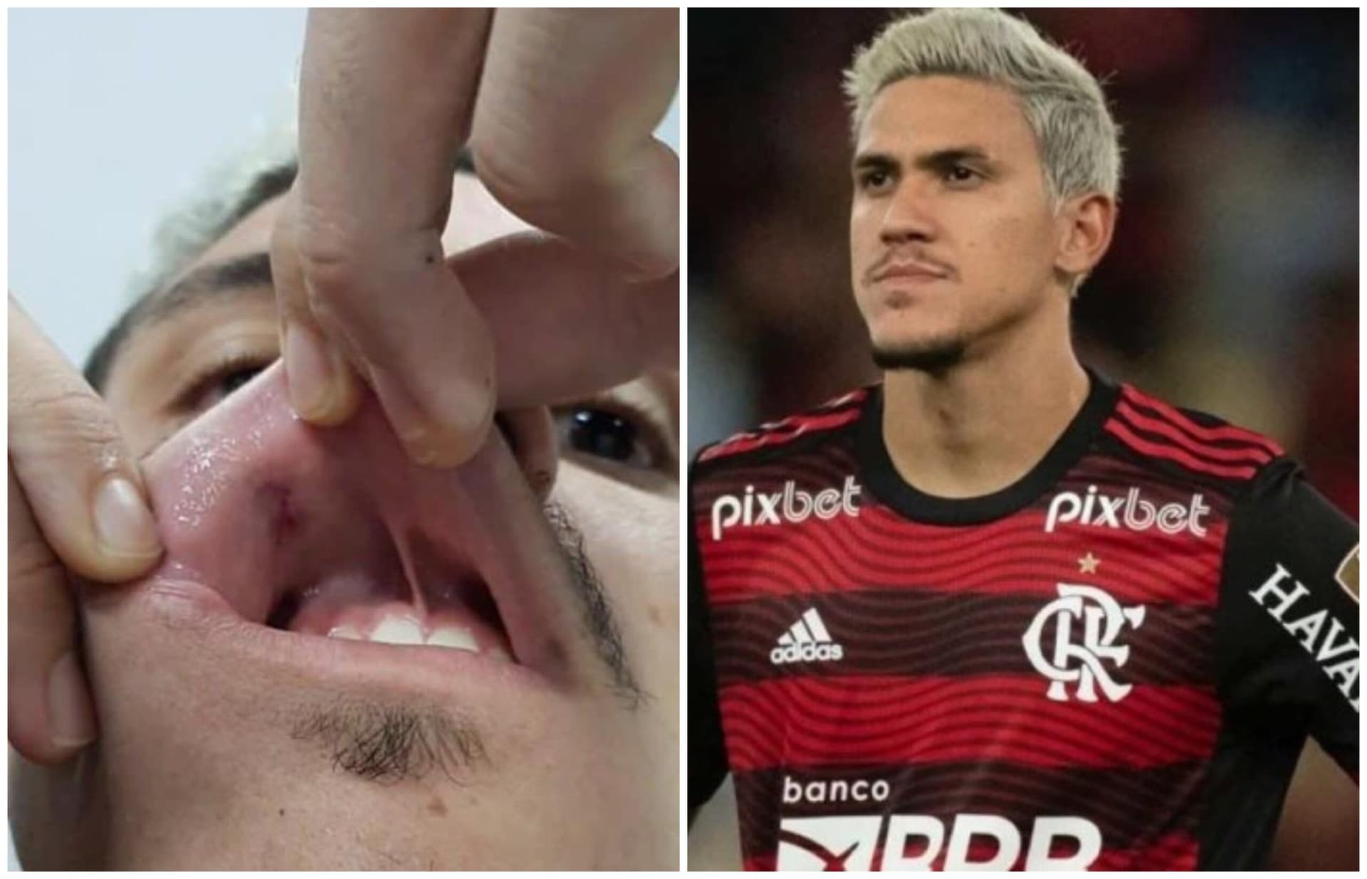 Briga no Flamengo: Pedro registra B.O após receber soco de preparador físico