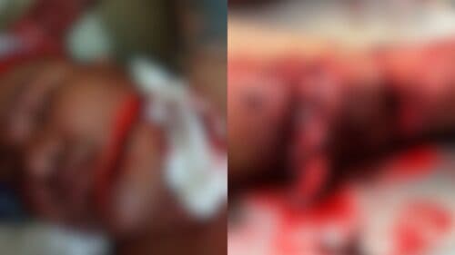 IMAGEM FORTE: Homem tem rosto e corpo cortados a terçadas, no AM