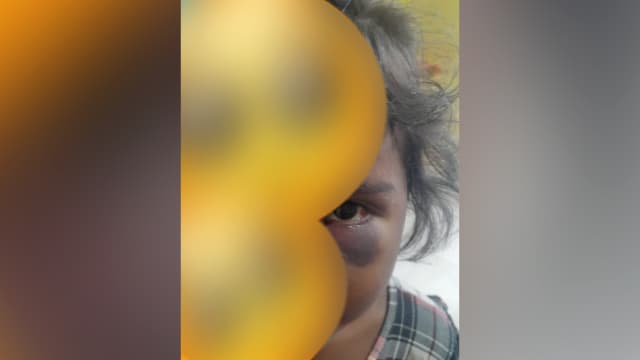 Criança de 3 anos é agredida durante briga de família, em Manaus