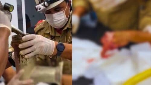 VÍDEO: Funcionário perde a mão ‘triturada’ em máquina de moer carne, em Manaus
