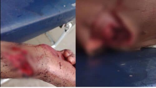 BRUTALIDADE: Morto a ‘terçadadas’, homem quase tem a cabeça decapitada, no AM