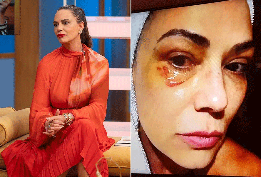 Luiza Brunet destaca data e fala sobre os tipos de violências contra a mulher