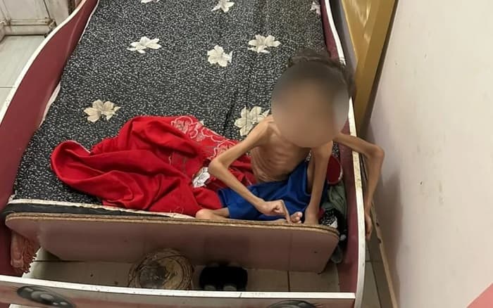 Menino de 7 anos é encontrado abandonado e desnutrido, e pais são presos, em GO