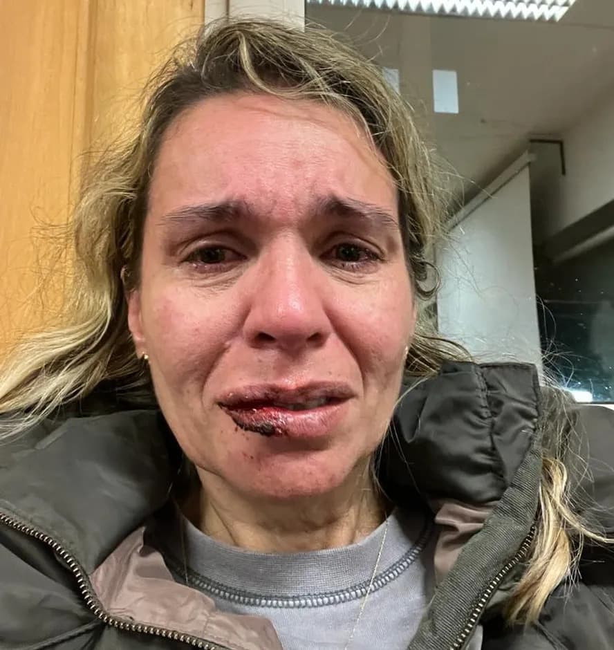 Brasileira é agredida com soco na boca em Universidade de Portugal