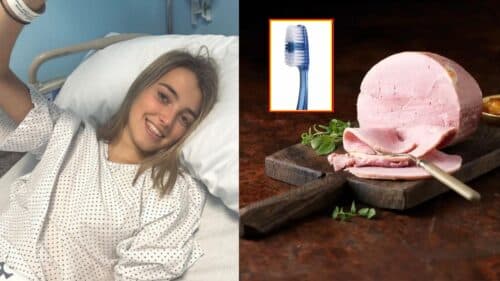 Jovem engole escova de dentes após tentar tirar pedaço de presunto da garganta