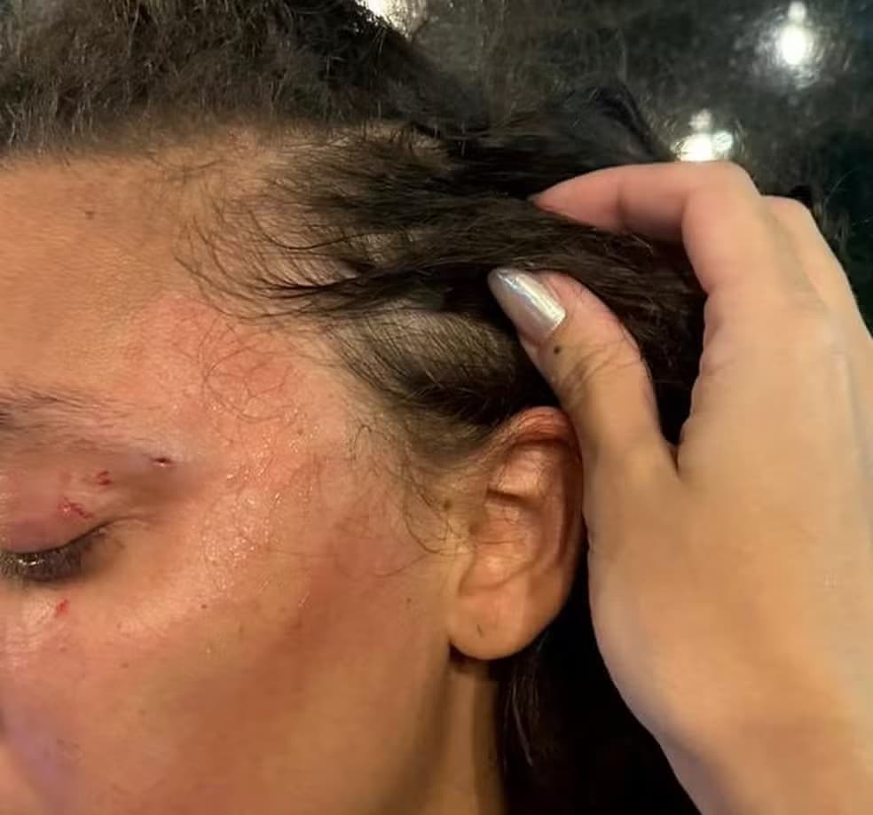 “Você é homem ou mulher?” diz agressor que deu soco em mulher na entrada de um banheiro em Recife