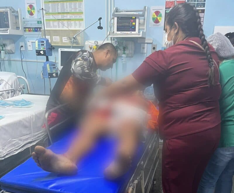 Irmão de “Zé Roberto” sofre atentado a tiros no bairro Compensa, em Manaus