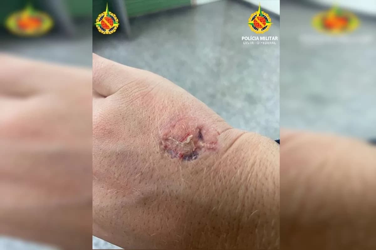 Dona de restaurante no DF é presa após morder policial em confusão por causa de conta