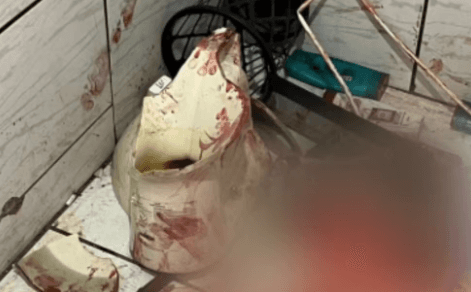 Em Goiás, mulher é internada após vaso sanitário em que ela estava sentada quebrar
