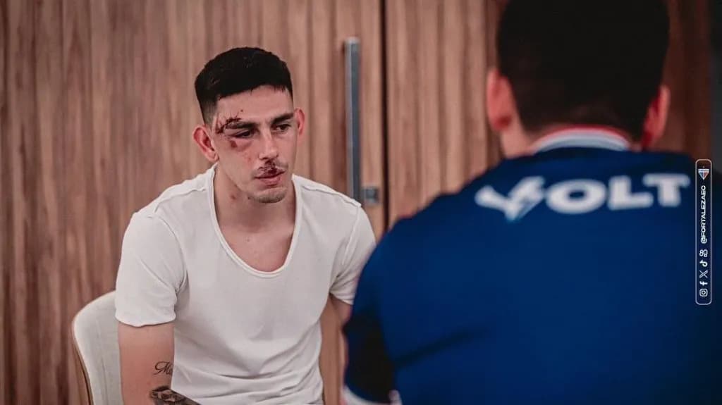 Jogador do Fortaleza mostra rosto machucado após ataque a ônibus; time chama ato de “terrorismo”