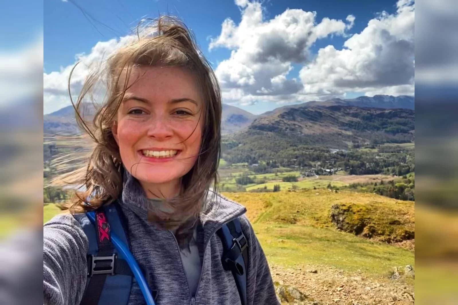 Coceira constante leva mulher na Inglaterra a descobrir doença rara no fígado