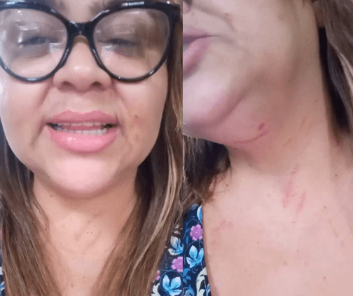 Cantora do Caprichoso é agredida por usar camisa de boi-bumbá