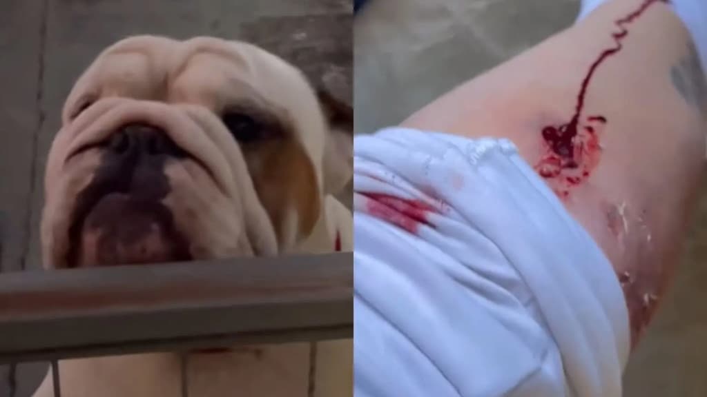 VÍDEO: Influenciadora é atacada pelo próprio cão e fica ferida, em SC