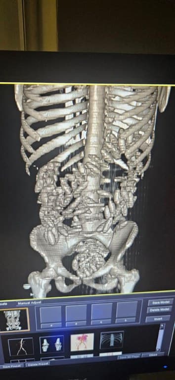 Seis jovens são presos com cápsulas de cocaína no estômago em aeroporto no RJ