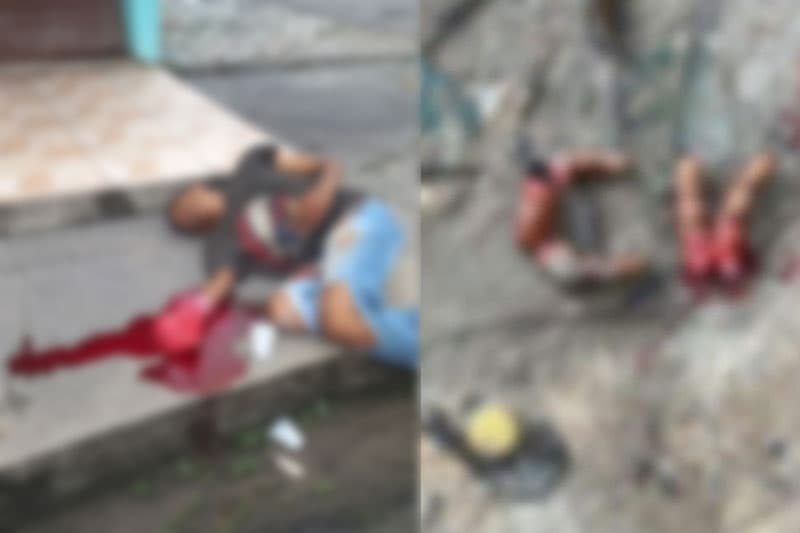 Dedos decepados de homem são usados para formar sigla do ‘CV’