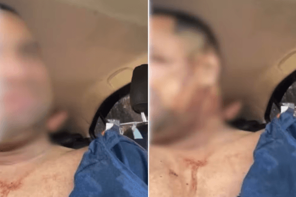 VÍDEO: Motorista de aplicativo faz vídeo após ser baleado em sequestro, em SP