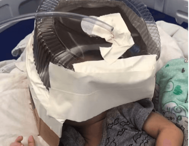 Hospital usa embalagem de bolo como máscara de oxigênio em bebê de 3 meses, no RN