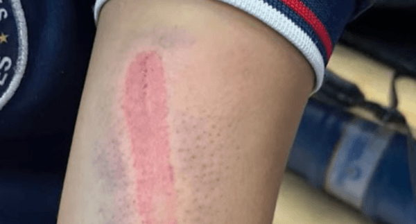 Mãe e padrasto são preso acusados de espancar filha de 15 anos em Manaus