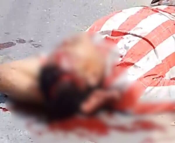 VÍDEO: Motociclista tem cabeça rachada e massa encefálica exposta durante acidente, em Manaus