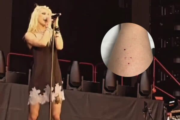 VÍDEO: Taylor Momsen, do The Pretty Reckless, é mordida por morcego durante show