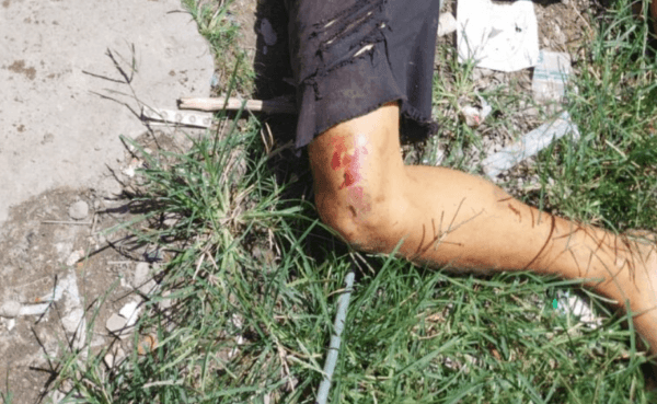 Homem é crivado de bala durante ataque criminoso na zona Leste de Manaus