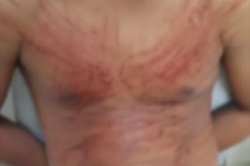 Homem esfaqueia o pai e depois tenta suicídio em Manicoré