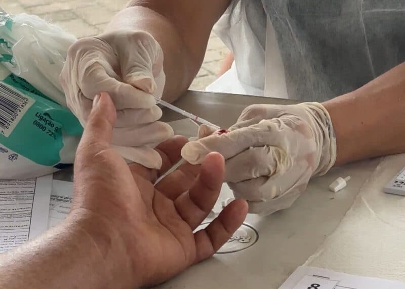 Amazonas registra redução de 33,4 % nos casos de hepatites