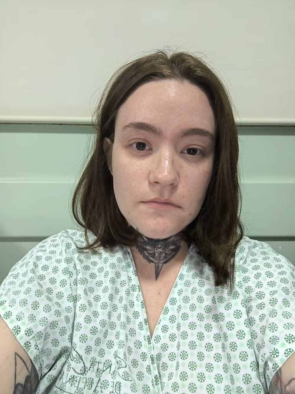 Jovem que sofre com “pior dor do mundo” e busca eutanásia sai de UTI e diz estar sem dor: “Experiência inédita”