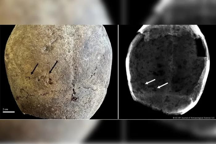 Múmias do século 17 na Europa apresentam sinais de uso de cocaína